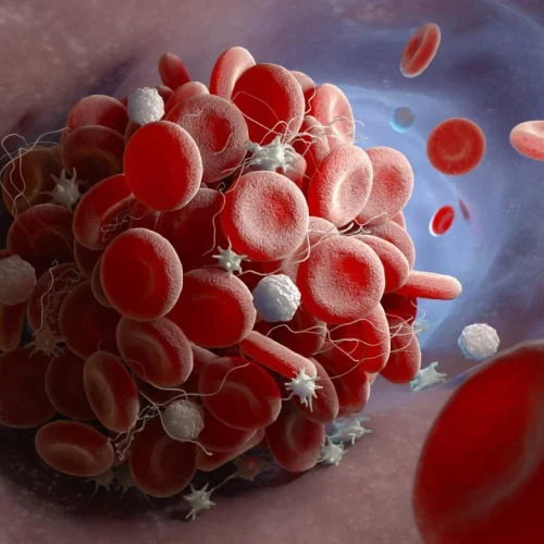 Trombosis con trombocitopenia